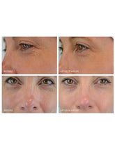 Load image into Gallery viewer, Medik8 Crystal Retinal 6 30ml